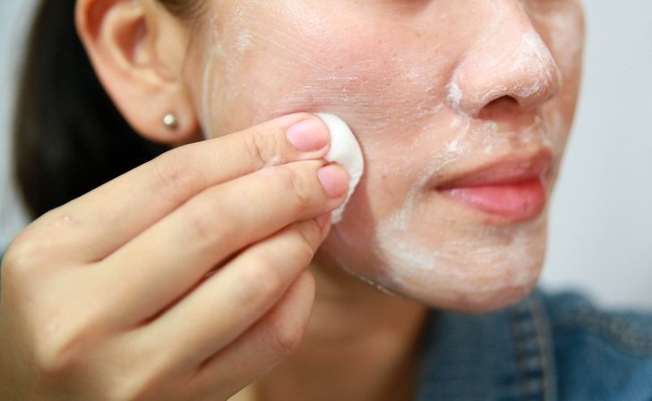 Freckles Treatment In A Natural Way